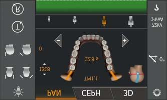 Sirona Dental Systems GmbH Käyttöohje ORTHOPHOS SL 2D / 3D 5 Käyttö 5.1 Röntgenkuvaus 0 15 15 0 5.1.2.2.4 Kulmaesiasetuksen valinta Kuvausohjelmassa TM1 voidaan valinta kulmaesiasetus (0, 5, 10 ja 15 ) leukanivelalueelle.