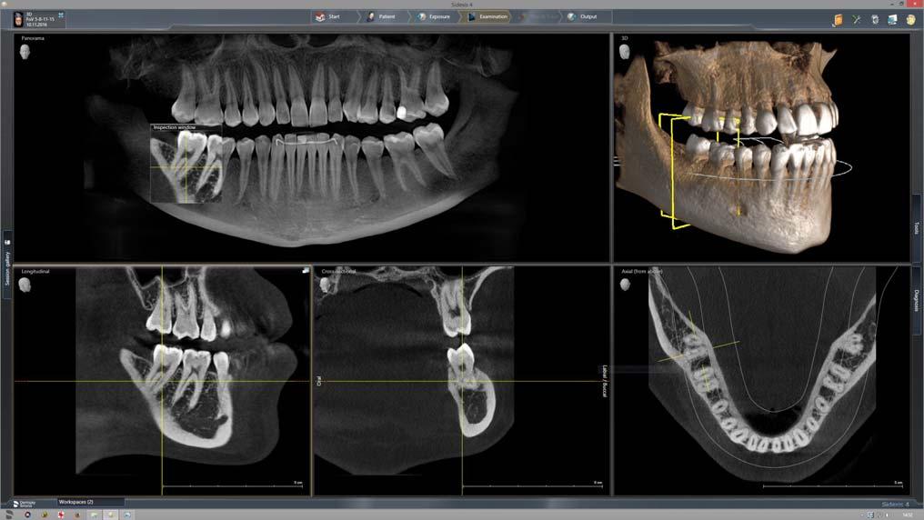 Sirona Dental Systems GmbH Käyttöohje ORTHOPHOS SL 2D /