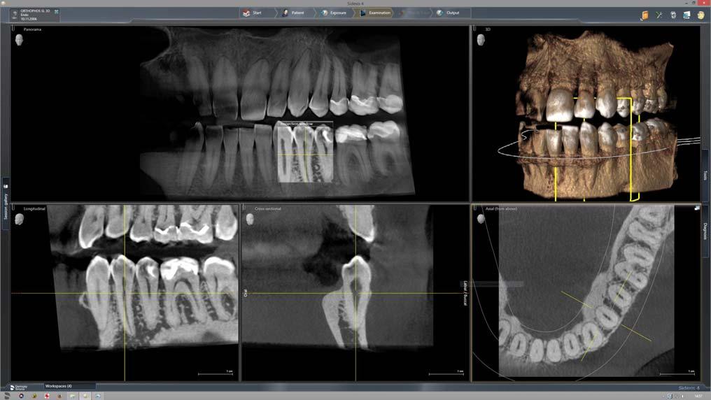 5 Käyttö Sirona Dental Systems GmbH 5.1 