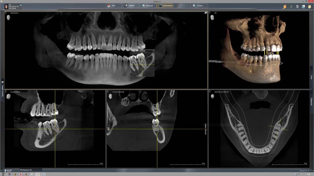 Sirona Dental Systems GmbH Käyttöohje ORTHOPHOS SL 2D / 3D 5 Käyttö 5.1 