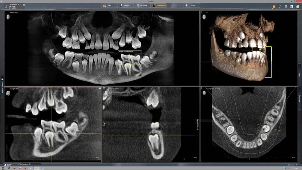 5 Käyttö Sirona Dental Systems GmbH 5.1 