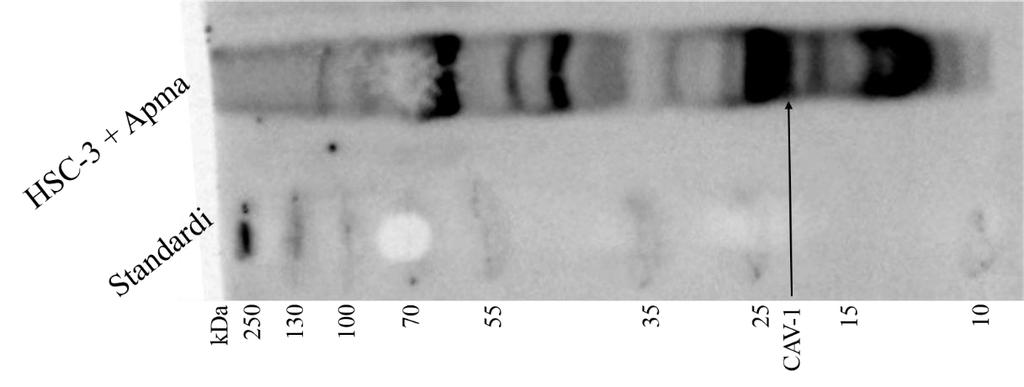 A C Kaveoliini-1 B Kuva 1 HSC-3 soluilta eristettyjä eksosomeja immunoelektronimikroskopiakuvassa (A ja B) ja APMA indusoitujen HSC-3 -solujen eksosomeista tehty Western Blot