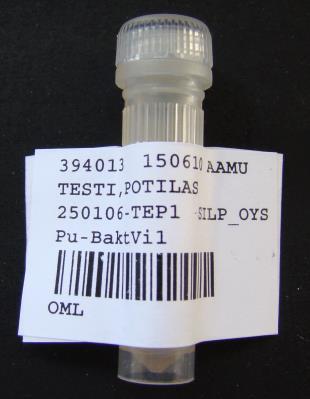 2 Näyte mikrotioputkeen, joita saa NordLab Oulun mikrobiologian laboratoriosta (040-635633).