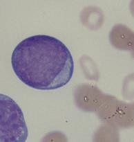14 (59) tuhoutuvat kudoksissa apoptoottisesti, jonka jälkeen makrofagit fagosytoivat ne. Tunnusomaista neutrofiileille on tuman liuskoittuminen ja sytoplasman vaaleanpunertavat granulat.