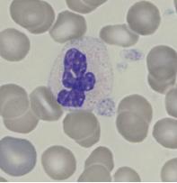 (kuva 11). Sytoplasma on kalpean sinistä tai väritöntä. Yleensä eosinofiili on suurempi kooltaan kuin neutrofiilit, 12 17 µm.