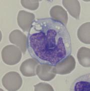 ) Monosyytti Kypsä monosyytti (kuva 17) on läpimitaltaan noin 15 25 µm ja se on yleensä suurin verenkierron