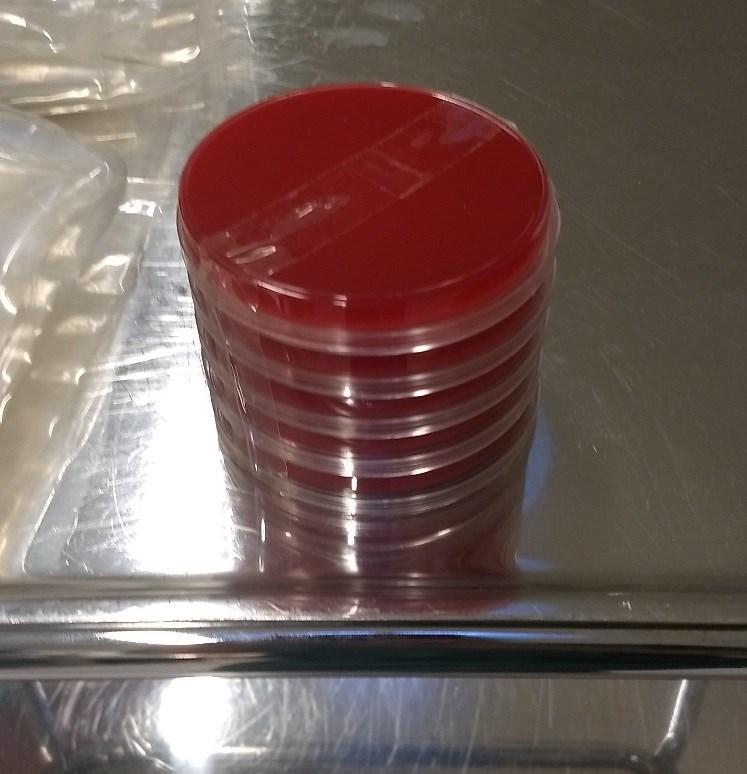 43 Kasvatusalusta: Veriagarmalja 90mm Kuva 15. Kasvatusalustana käytetty veriagarmalja 90mm.