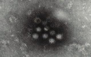 Norovirus on tehokas leviämään Voi tarttua sekä aikuisiin että lapsiin Matala infektiivinen annos Korkea pitoisuus virusta oireilevien ulosteessa ja oksennuksessa Pitkä