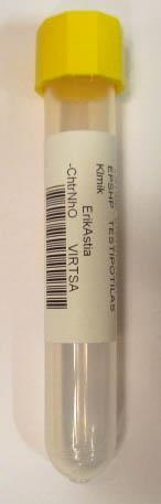 Laatija: A.Saarinen 08.05.2017 4 -CtNgNhO (1738) Chlamydia trachomatis ja Neisseria gonorrhoeae, nukl.