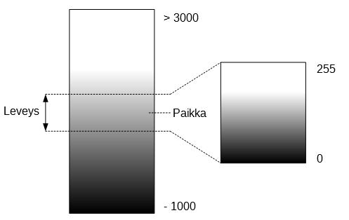 11-1024 +3071 siten, että tiheät rakenteet, kuten luu, näytetään valkoisena ja vähemmän tiheät, kuten ilma, mustana (Gibson 2009, 10; Kalender 2011, 32).