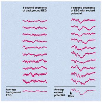 18 KUVA 7. Auditiivisen herätevasteen keskiarvoistus. Keskiarvoistamalla monta vastetta saadaan vähennettyä muun EEG:n kohinaa. (Methods of Studying the Nervous System 2016, muokattu.