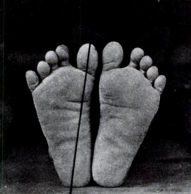 KUVA 5. Luonnollisesti kehittyneet jalat (Hoffman 1905, 107). Paljain jaloin kävelevien ihmisten jalat eroavat kenkiä käyttävien jaloista muodoltaan ja kuormittumiseltaan. D Aout ym.