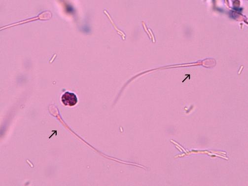 KUVA 12. Siittiöitä Hiivat ja parasiitit ovat harvinainen löydös virtsasta. Koiran ja kissan virtsasta voi löytyä parasiitin munia tai jopa aikuisia parasiittejä.