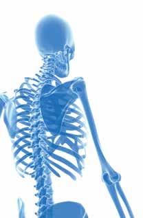 Maailmanlaajuisesti yksi kolmesta yli 50-vuotiaasta naisesta ja yksi viidestä yli 50-vuotiaasta miehestä saa osteoporoottisen murtuman.