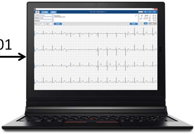 printimine Puudused: Igal EKG seadme tootjal on oma andmebaasi ja failiformaat Igal tootjal on oma