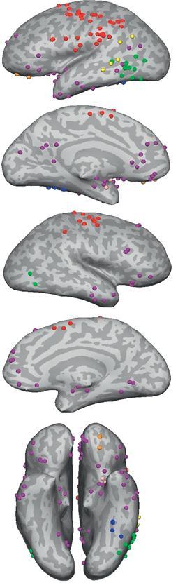 Alueet missä on havaittu kategoria-spesifiä aktivaatiota kielellisen semanttisen tiedon prosessoinnin yhteydessä Binder & Desai, 2011 (38 aivokuvantamistutkimusta) Liikkeeseen liittyvä tieto