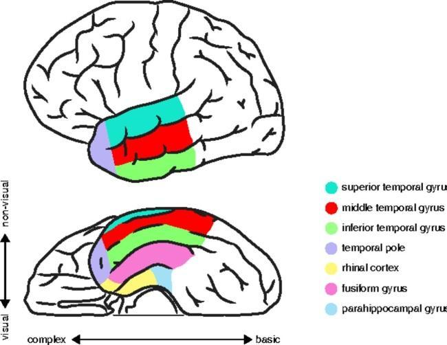 Aivovauriopotilaan semanttisen häiriön (semantic dementia) rajoittuminen yksittäiseen kategoriaan Vaurio sensori-motorisen järjestelmän rajatulla alueella (ventraalinen temporaalinen näköjärjestelmä