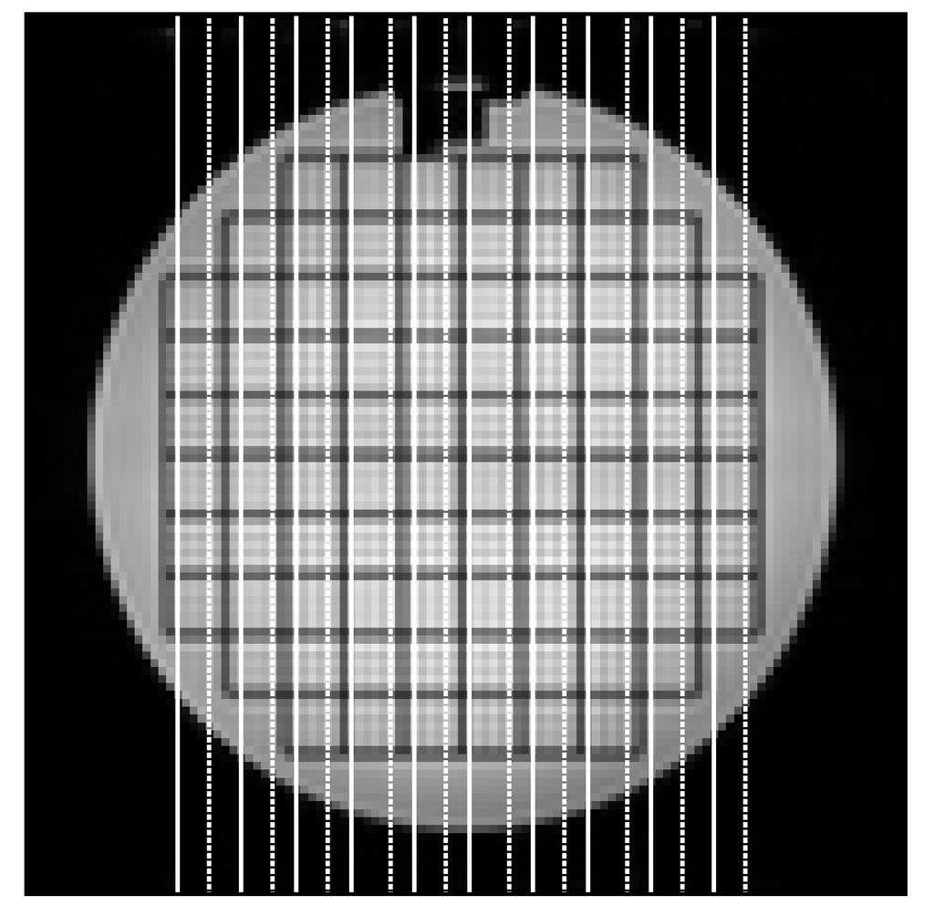3.2 EPI-vääristymät 28 Kuva 9: Pystysuuntaisten signaalikatoalueiden paikantaminen ACR-fantomin viidennestä leikkeestä T1-kuvassa.