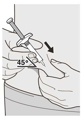 Vaihe 9: Pistä Työnnä neula ihopoimuun noin 45 asteen kulmassa.