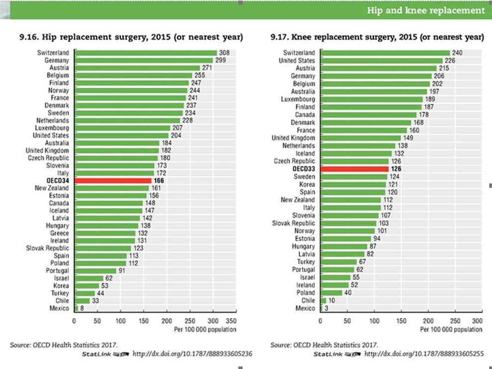 5 Tekonivelkirurgia OECD-maissa OECD-maiden vertailussa Suomen lonkan ja polven tekonivelkirurgian suoriteluvut väestömäärään suhteutettun ovat kärkisijoilla vuoden 2015 tilastovertailussa (20) (kuva
