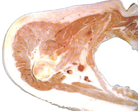 acromion et spina scapulae, olecranon ulnae, epicondylus humeri mediale et laterale - Ihon, ihonalaiskudoksen, syvän peitinkalvon rakenne; - Yläselän hartian ja olkavarren pinnallisten ja syvien