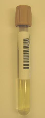 Ohje ja versio: Näytteenottovälineet-10 Sivu 10/17 Fl-StrBNhO (8591) Streptoccus agalactiae (B), nukl.happo vagina- ja rectumnäytteistä Cepheid Swab Collection Kit Huom!