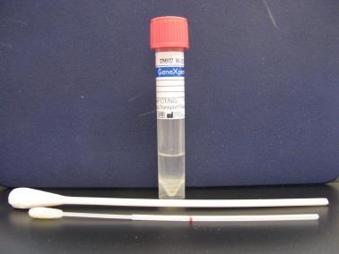 happo CERVIX/URETRA SILMÄ, NIELU Chlamydia trachomatis ja Neisseria gonorrhoeae A) cervix/uretra TAI B) cervix/uretra silmä, nielu Xpert CT/NG Vaginal/Endocervical Specimen Collection Kit ThinPrep