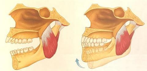 ) Pterygoidius eli ulompisiipilihas nostaa alaleukaa yhdessä masseterin ja temporaliksen kanssa.