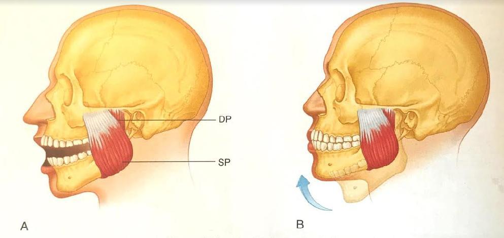 Masseter eli ulompi puremalihas on neliömäinen lihas kasvojen sivussa ja se kiinnittyy mandibulan