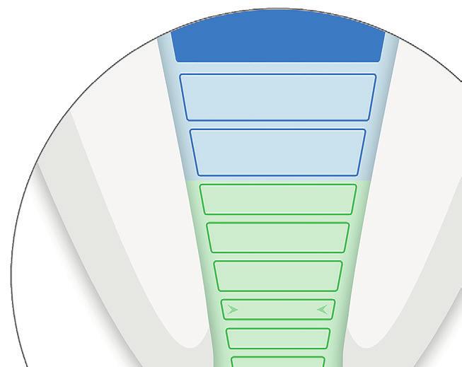 E Propex IQ -juurikanavamittarin mukautus Suorita aina suljetun kierron testi ennen hoitoa (katso kohta 3).