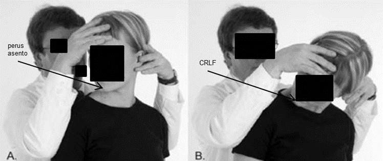 15 Kuva 3. Adsonin, Costoclavikulaari, Wrightin ja Roosin testit. (mukaillen Parziale ym. 2010). CRLF testiä (kuva 4) käytetään arvioidessa rintakehän yläaukeaman toimintaa (funktiota).