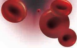 Kuljetuksen vaikutus Vaikea inhibiittoripositiivinen A-hemofilia, jolla ITI hoito Vasteen seurantaa varten