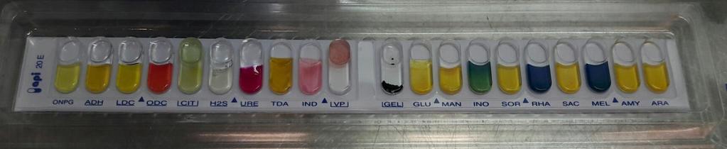 5.2. Bio- ja serotyypityksen tulokset Kaikkien 26 kannan laji määritettiin käyttäen API 20E:tä ja muita biotyypitysreaktioita. Kannoista 22 oli Y. enterocoliticaa ja neljä ympäristölajia Y.