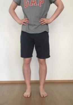 61 Liite 2 SINGLE-LEG STANCE Testiohjeet: 1. Pyydä testattavaa seisomaan lantion levyisessä asennossa. 2. Pyydä testattavaa asettamaan kädet lantiolle ja nostamaan toisen jalan irti lattiasta.