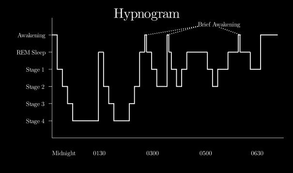 JOHDANTO REM (Rapid Eye Movement) univaihe jonka aikana aivot ovat hyvin aktiiviset ja keho lähes halvaantunut Poikkeaa merkittävästi NREM-univaiheesta Tavallisen yön