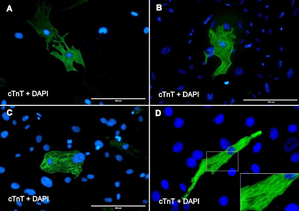 Figure 11. Representative immunofluorescence images of Day 14 HNGMT (Hand2, NKX2.