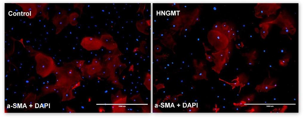 they transdifferentiate into myofibroblasts, which is most likely the cause of α-sma expression the control cells and in most HNGMT-transduced cells. Figure 13.