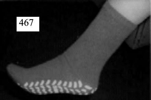 Luokittelu määräytyy yhdistetyn nimikkeistön 1 ja 6 yleisen tulkintasäännön sekä CN-koodien 6114 ja 6114 30 00 nimiketekstin mukaan.