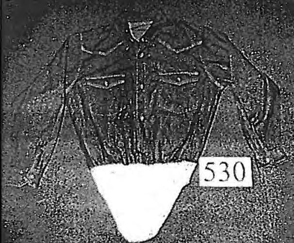 6205 20 00 Vaate (100 % puuvillaa), peittää vartalon jalkoväliin saakka, yläosa kangasta, kaulus, pitkät, väljät hihat, jotka sulkeutuvat ranteista painonapein ja kaksi taskua rinnan korkeudella.