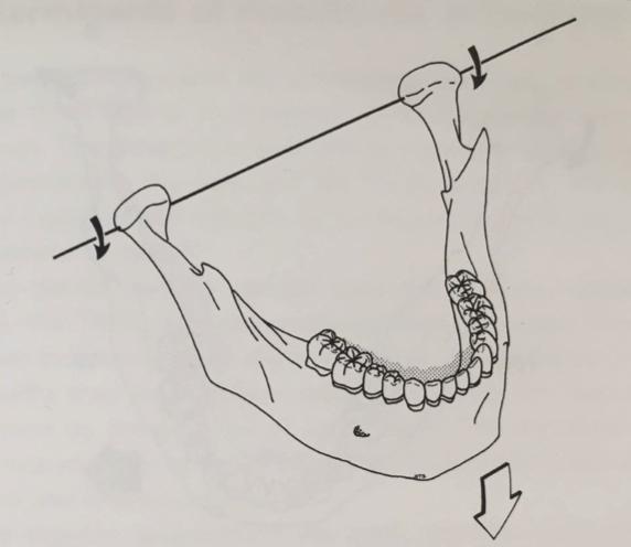 Horisontaalinen akseli (kuva 3): Sagittaalitasossa tapahtuu liike, kun nivelasemassa oleva alaleuka tekee puhtaasti rotaatioliikkeen avaamisen ja sulkemisen aikana transversaalisen horisontaalisen