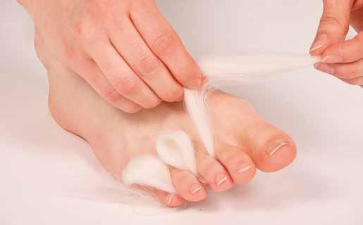 Vaivaisenluun alueen ihoa voidaan suojata kengän aiheuttamalta hankaukselta vaivaisenluulaastarilla tai suojaputkella.