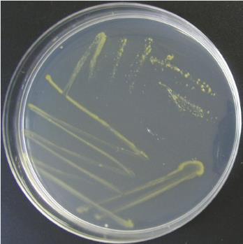 Flavobacterium psychrophilum aiheuttaa kylmän