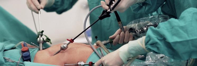 VATSAONTELON TÄHYSTYS Aikaisemmin vatsaontelon tähystyksiä tehtiin enemmän, mutta nykyään kaikututkimus ja muut kehittyneet kuvantamismenetelmät ovat vähentäneet niiden tarvetta.