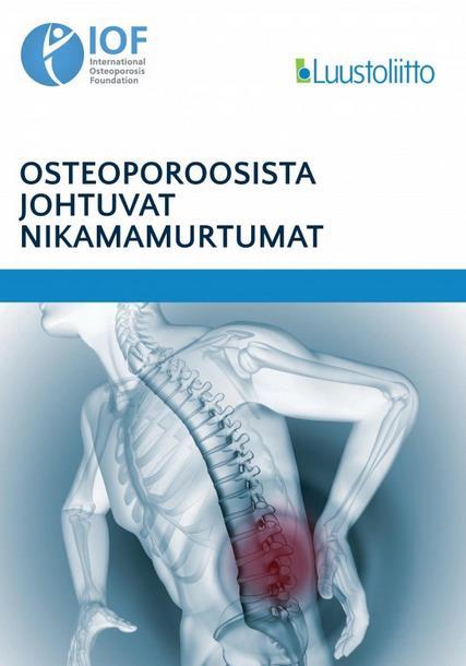 LUUSTOVIIKKO: NIKAMAMURTUMA Osteoporoosista johtuvat nikamamurtumat Maailmassa uusi nikamamurtuma 22 sekunnin välein Euroopassa välittömät