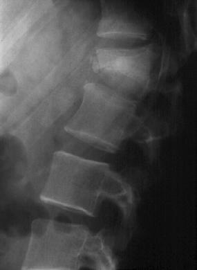 2001;12(2):85-90; Osteoporoosi: Käypä hoito -suositus, 2014 (viitattu