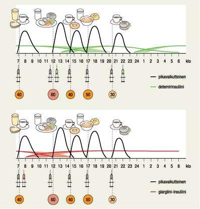Insuliinin korvaushoito pyrkii jäljittelemään normaalia insuliinin eritystä Monipistoshoito Perusinsuliini 1-2 kertaa vrk Detemir (Levemir)