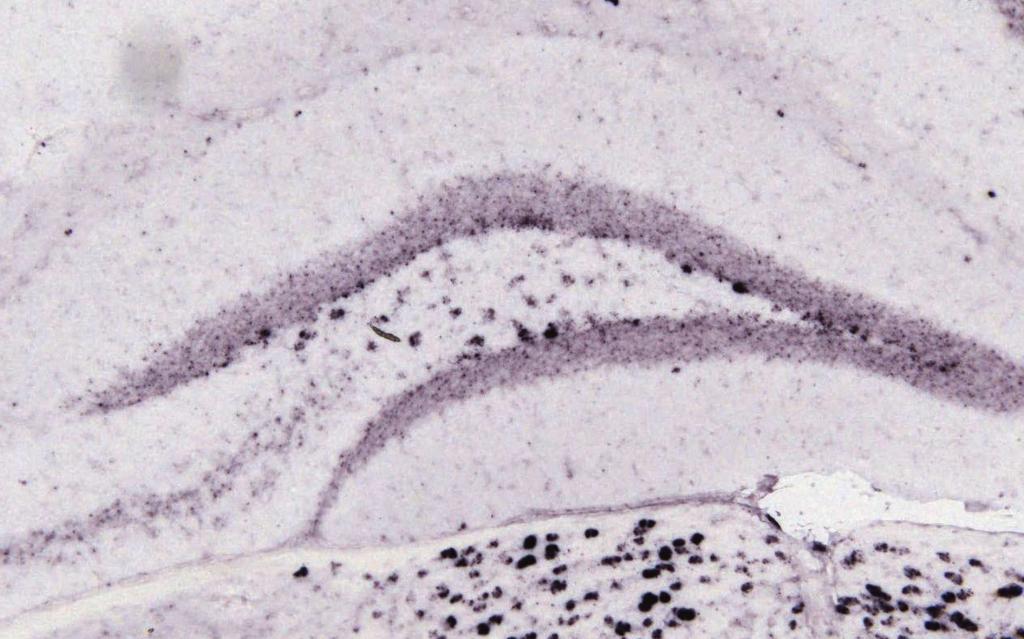 anti-kalretiniinilla, B