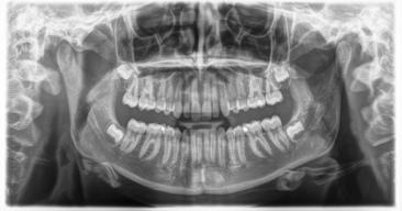 Sirona Dental Systems GmbH 5 Käyttö 5.