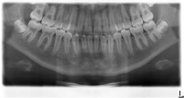 Sirona Dental Systems GmbH 5 Käyttö 5.4.1.