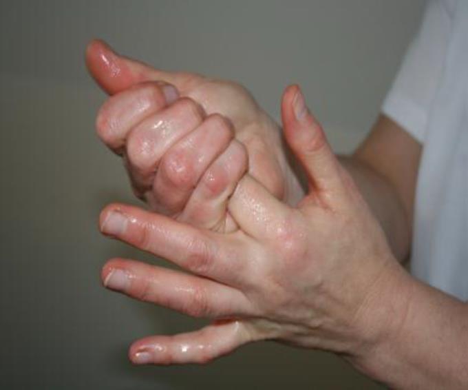 Käsihygienia Tärkein osa-alue infektioiden ehkäisyn kannalta Käsien desinfiointi aina Ennen suojakäsineiden pukemista